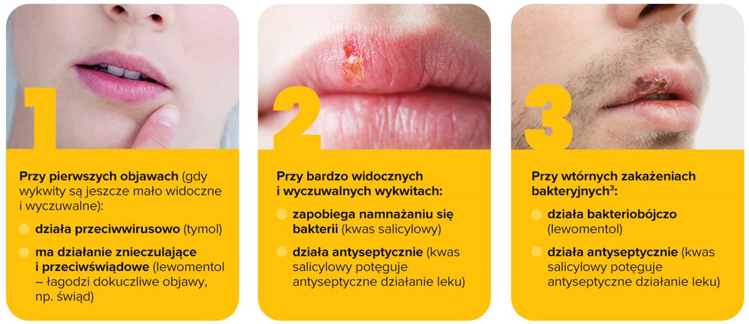 Verco Grafika 4