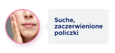 Bayer Zdjęcie 14