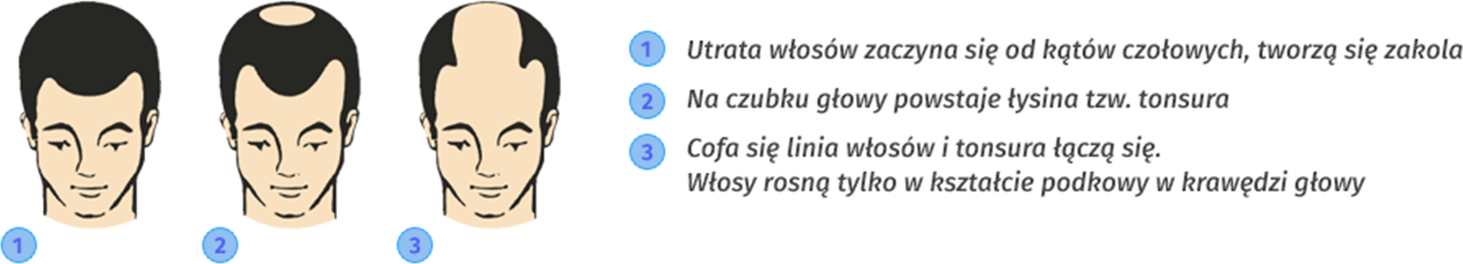 łysienie
