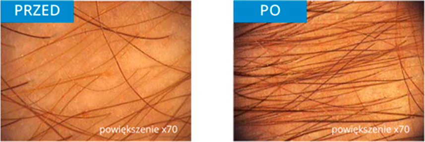 dermiec