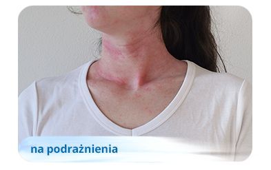zinalfat