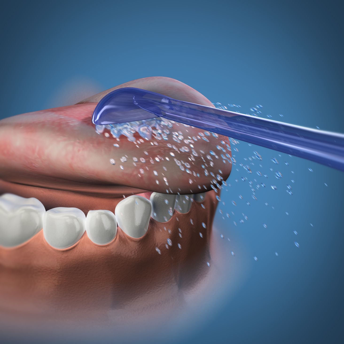 Waterpik Zdjęcie lifestyle 1