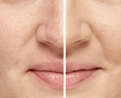 L’Oréal Paris Infaillible More Than Concealer