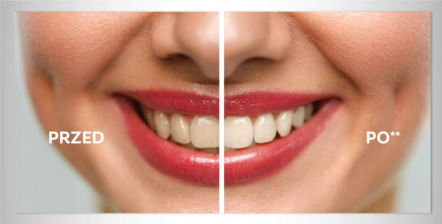 Colgate wizualizacja