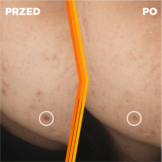 Garnier Vitamin C serum na przebarwienia