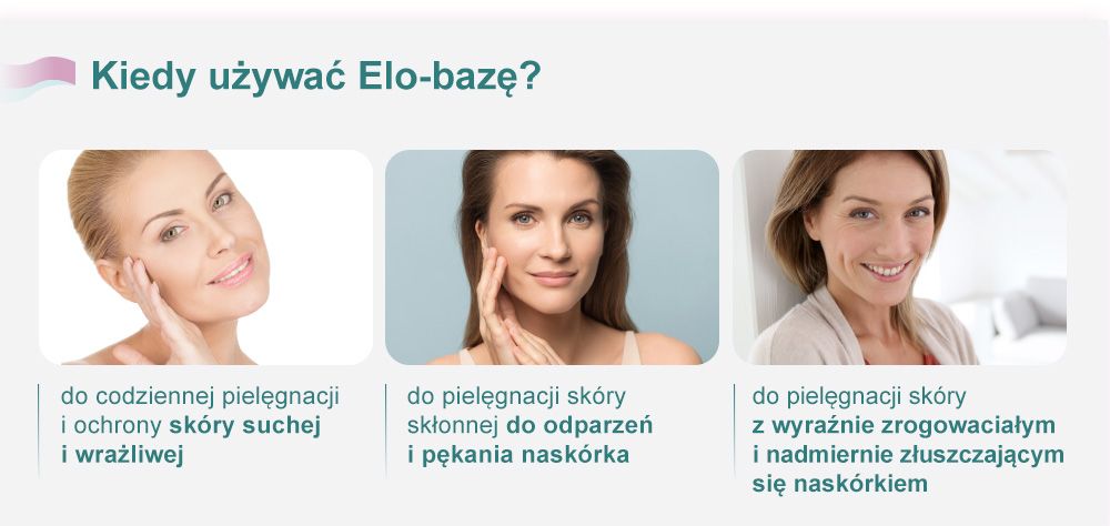 Kiedy używać Elo-bazę?