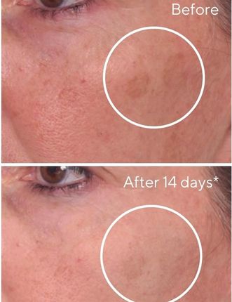 Murad Rapid Dark Spot Correcting Serum Serum Do Twarzy 30 ml - zdjęcie 3