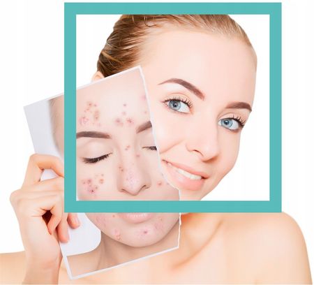 Krem Dr Duda ACNE-MINERAL cera trądzikowa na dzień i noc 50ml - zdjęcie 2