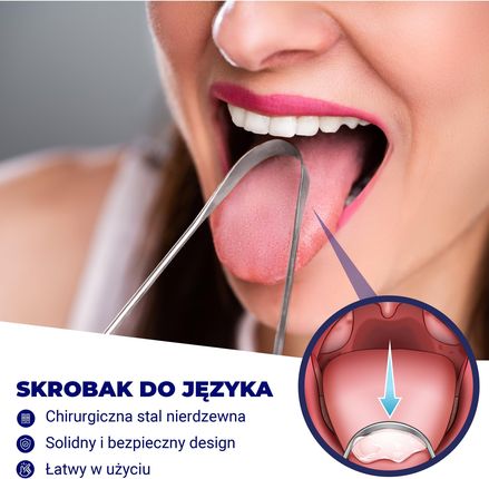 Kamienie migdałkowe białe gródki w gardle detryt - zdjęcie 3