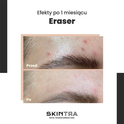 Skintra Eraser Serum Na Przebarwienia Z Witaminą C 10% 30Ml - zdjęcie 2