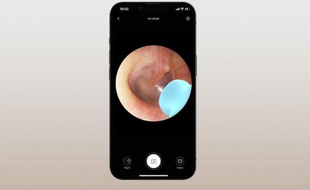 Bebird Otoskop Z Kamerą M9 S Czarny - zdjęcie 2