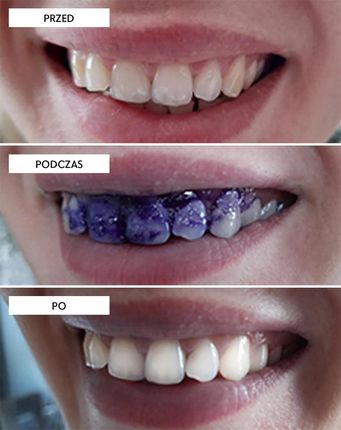 Smilebite White Bite korektor koloru 30 ml - zdjęcie 2