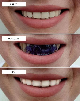 Smilebite White Bite korektor koloru 30 ml - zdjęcie 4