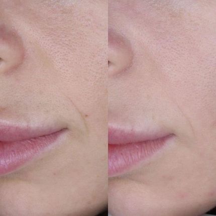 Yvette Elixis Holistic Beauty Drink 700 ml – wysokocząsteczkowy kwas hialuronowy do picia - zdjęcie 2