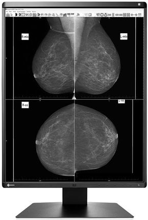 Eizo 21,3