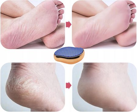 Pumeks Kryształowy Tarka Do Stóp Z Nano Szkła 3D Do Pięt Stóp Pilnik - zdjęcie 2
