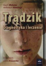 Trądzik Diagnostyka i leczenie