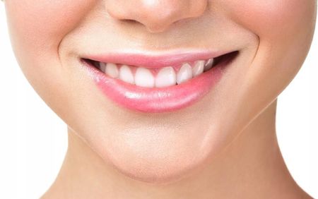 Dentaid Vitis Szczoteczki międzyzębowe Interprox Plus MIX 6 sztuk - zdjęcie 3
