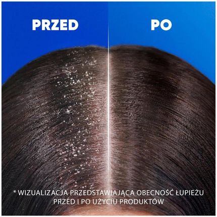 Head & Shoulders Menthol Szampon Przeciwłupieżowy 400 ml - zdjęcie 4