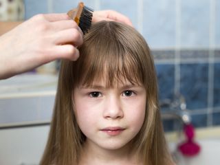 jak wyglądają wszy u dzieci