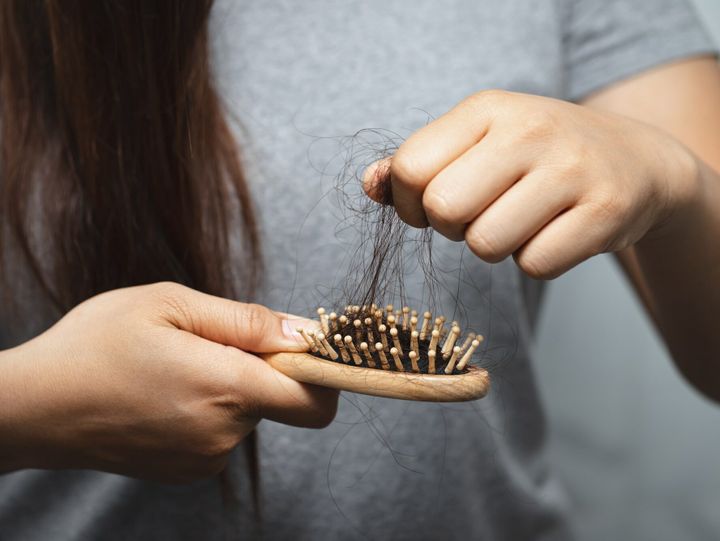 Women have hair loss problems