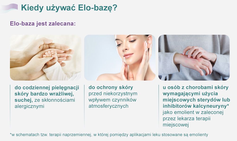 Kiedy używać Elo-bazę?