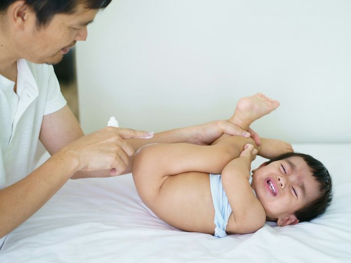 Asian father applying topical cream to baby boy for skin care to relief diaper rash itching.