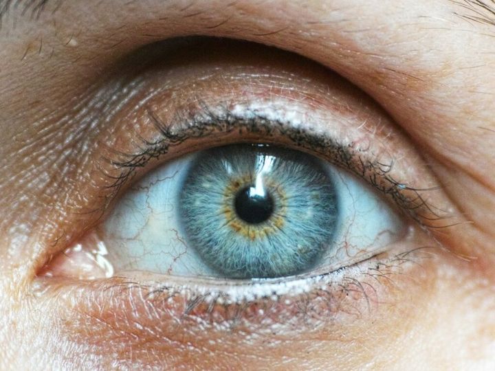 Spuchnięty wewnętrzny kącik oka: jakie są możliwe przyczyny i leczenie