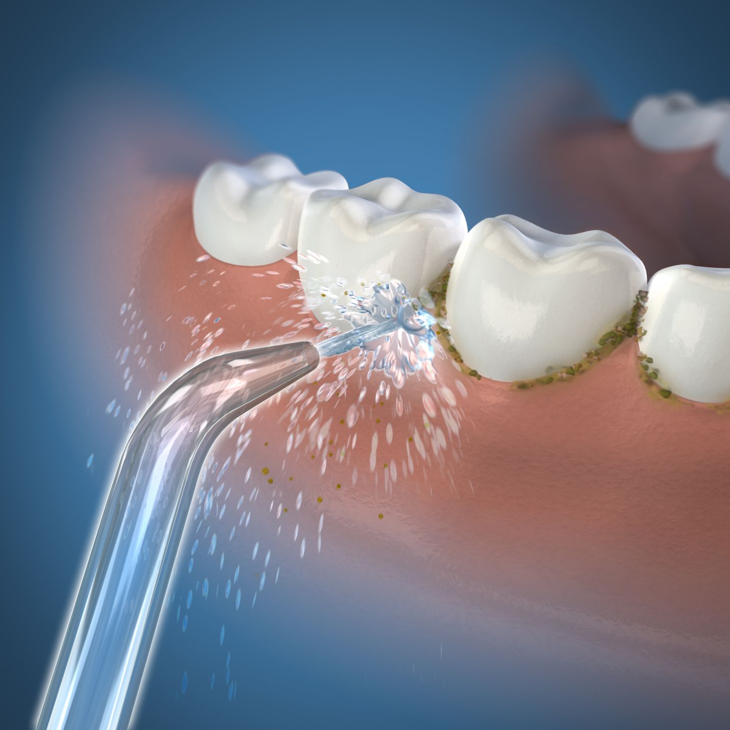 Waterpik Zdjęcie lifestyle 1