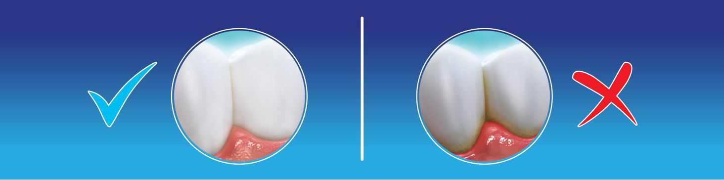 Meridol baner