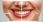 Colgate Max White Overnight aplikator wybielający 2,5ml - zdjęcie 6