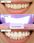 Smilebite Light & Bright urządzenie do wybielania zębów z nakładką LED i żelem wybielającym 1 szt. - zdjęcie 2