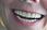 Fittydent Podkładki Mocujące Protezę Zębową 15szt - zdjęcie 3