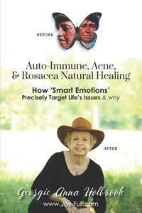Auto-Immune, Acne, & Rosacea Natural Healing - How 'Smart Emotions' Precisely Target Life's Issues & Why - Georgie Anna Holbrook