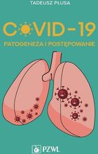 Zdjęcie COVID-19. Patogeneza i postępowanie - Rydzyna