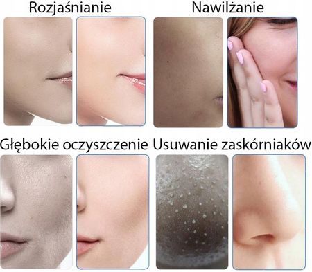 Calissimo Oczyszczanie Wodorowe Hydrabrazja Infuzja Tlenowa - zdjęcie 3