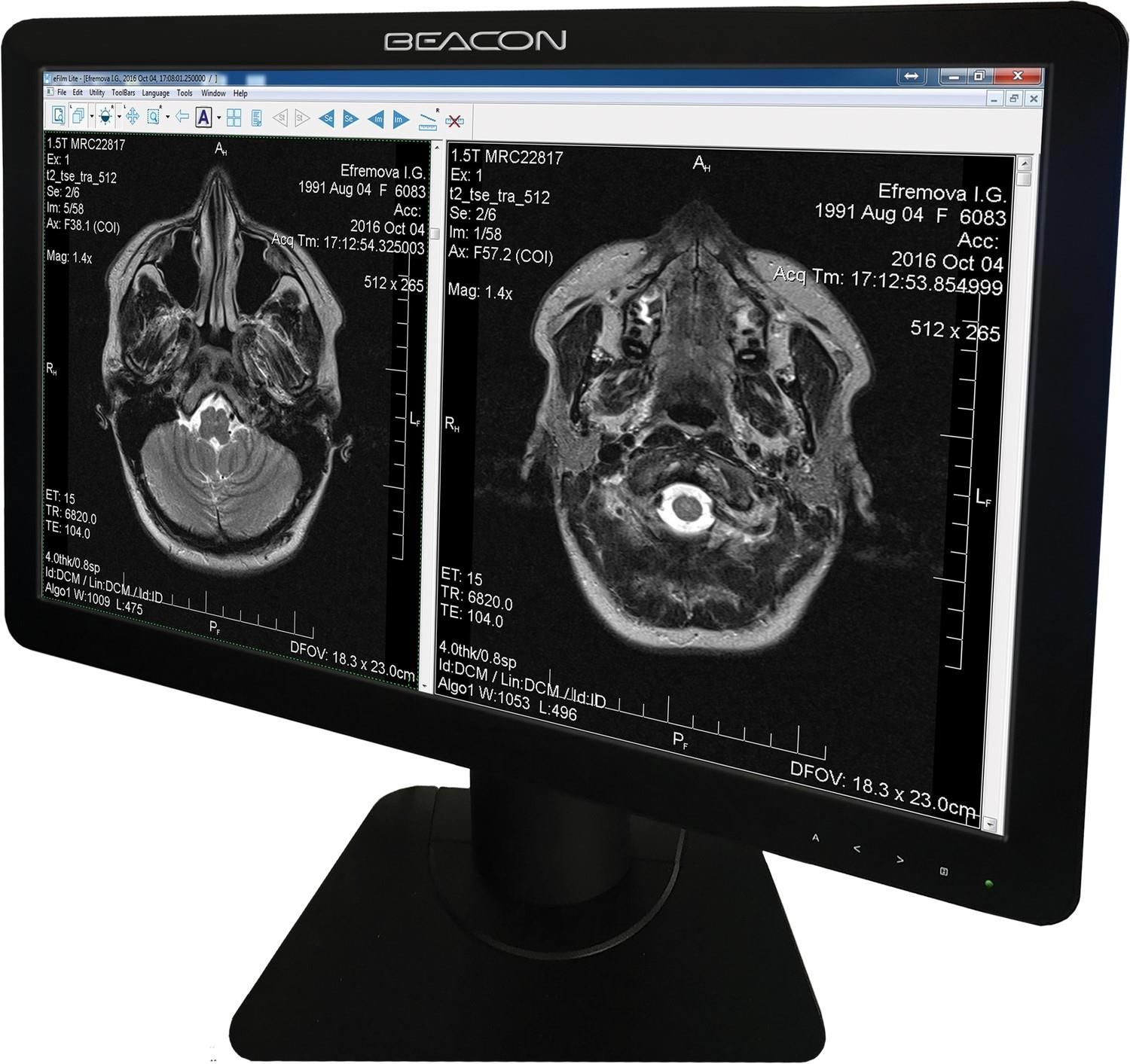 Monitor Beacon Display (C25W) - Opinie i ceny na Ceneo.pl