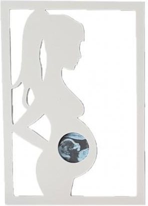 Moliland Ramka wisząca USG ciążatka biała USG