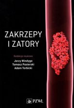 Zdjęcie Zakrzepy i zatory - Wrocław