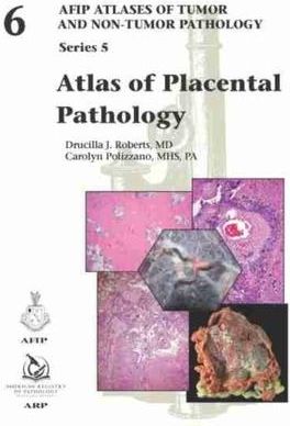 Atlas of Placental Pathology Roberts, Drucilla J.; Polizzano, Carolyn