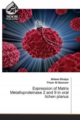 Expression of Matrix Metalloproteinase 2 and 9 in
