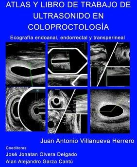 Atlas y Libro de Trabajo de Ultrasonido en Coloproctolog