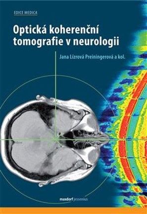 Optická koherenční tomografie v neurologii Tušl a kol