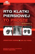 Zdjęcie RTG klatki piersiowej To proste - Wojnicz