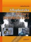 Zdjęcie Alloplastyka stawu biodrowego - Konin