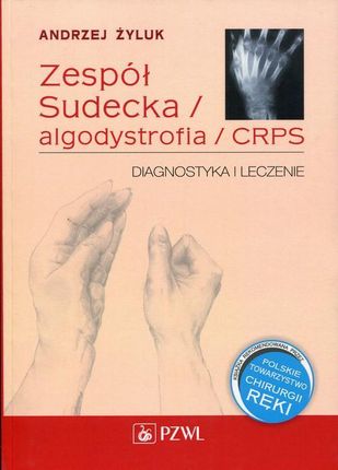 Zespół Sudecka / Algodystrofia / CRPS Diagnostyka i leczenie (E-Book)