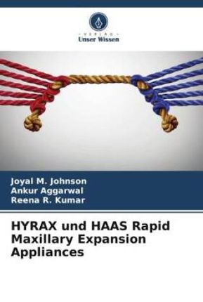 HYRAX und HAAS Rapid Maxillary Expansion Appliances
