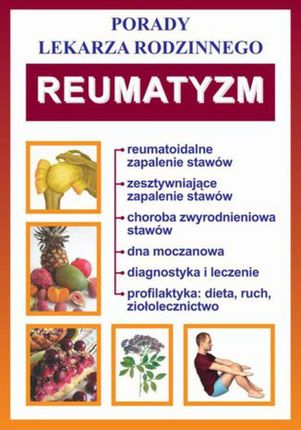 Reumatyzm. Porady lekarza rodzinnego - Praca zbiorowa (E-book)