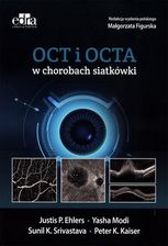 Zdjęcie OCT i OCTA w chorobach siatkówki - Olszyna