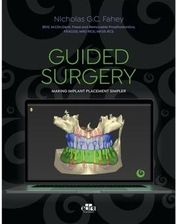 Guided Surgery Chakraborty, Shannon